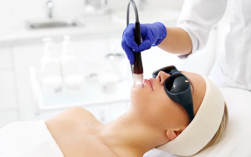 Dermatologia – Laser e Tecnologias Dermatologia – Laser e Tecnologias Elisete Crocco