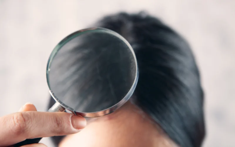 Dermatologia – Cabelos e unhas Dermatologia – Cabelos e unhas